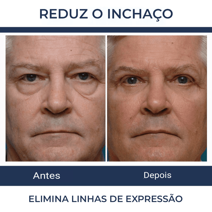 OPENEYES Lifting Gel - Renovação da área dos olhos.
